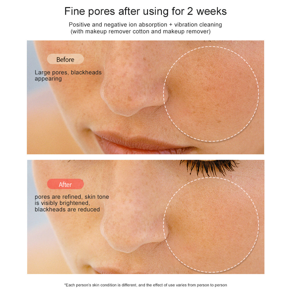 RF Face Lifting Machine EMS Pulse Therapy Device Skin Rejuvenation Micro Current Wrinkle Remover