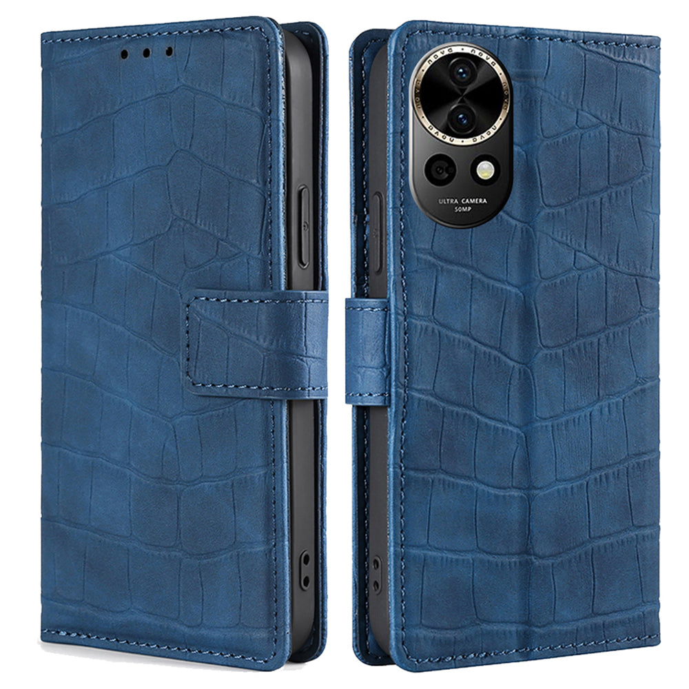 For Huawei nova 12 5G Case Crocodile Texture Leather Wallet Cover with Magnetic Clasp